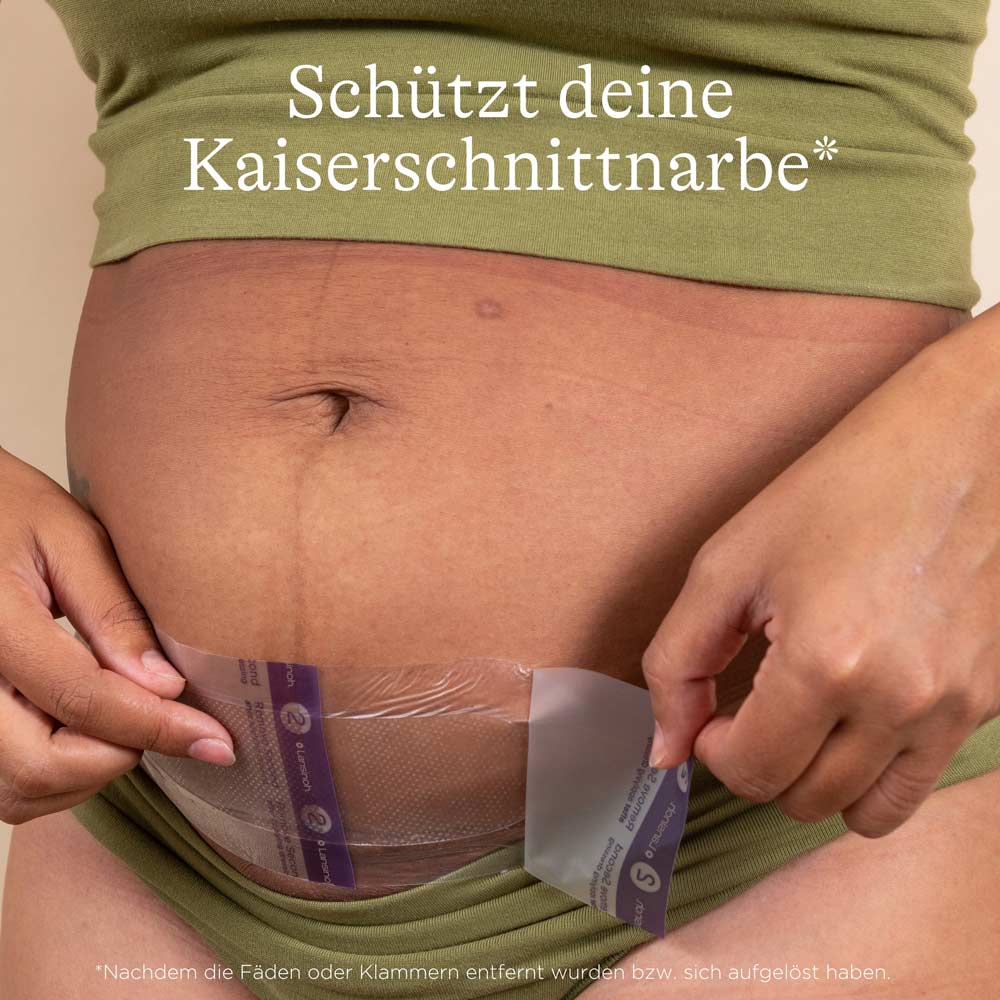 lansinoh-kaiserschnitt-hydrogel-pads-narbenpflege image 2